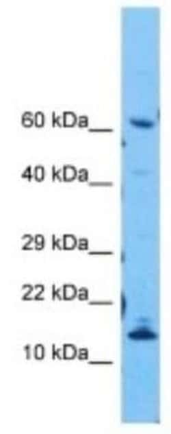 ORMDL2 Rabbit anti-Human, Polyclonal, Novus Biologicals 100 &mu;g | Buy Online | Novus Biologicals | Fisher Scientific